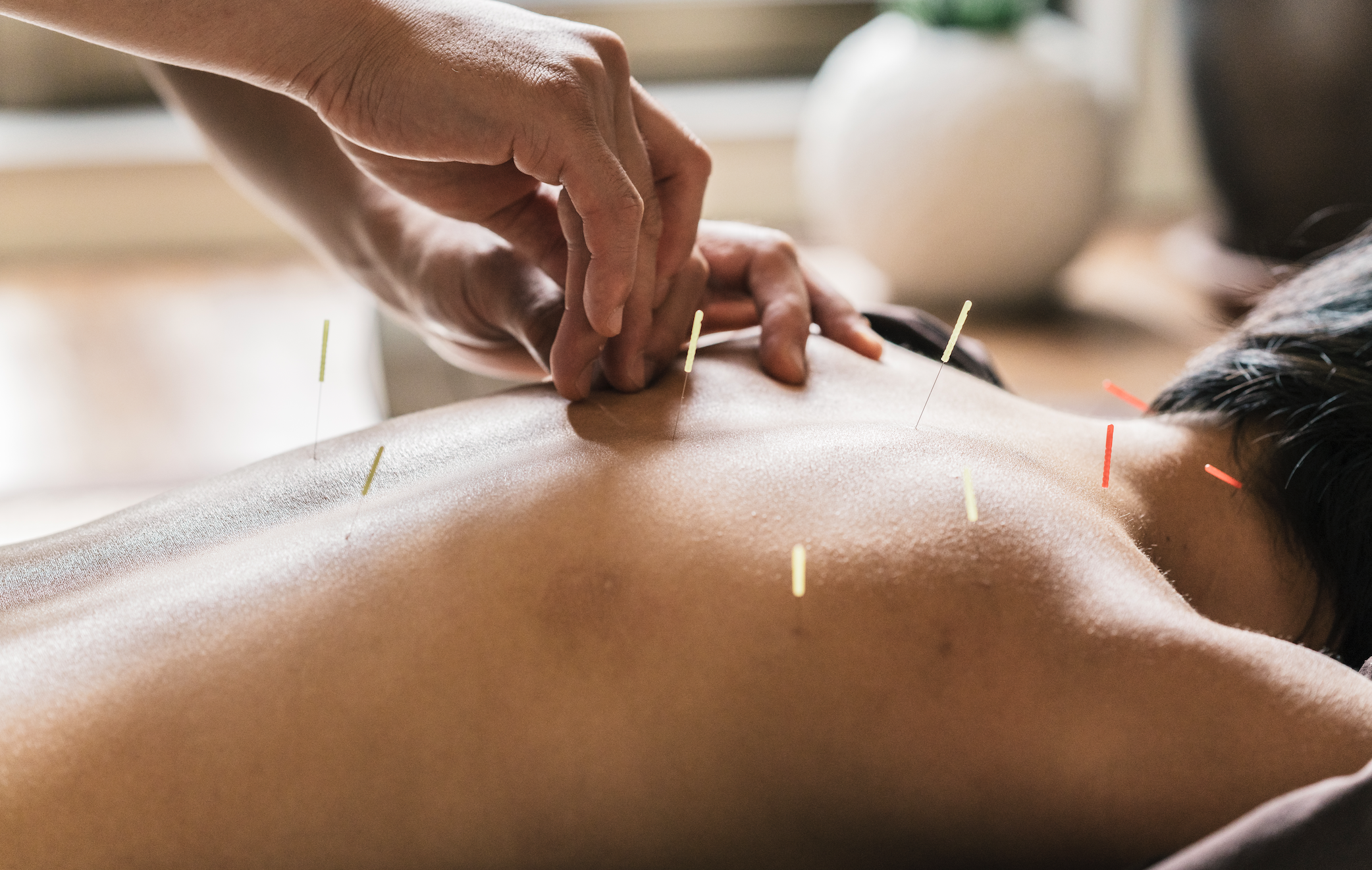 Quand aller voir un médecin acupuncteur ?